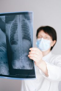 A doctor looking at an X-ray